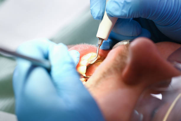 Best Emergency Treatment for Oral Infections in Arcadia, SC