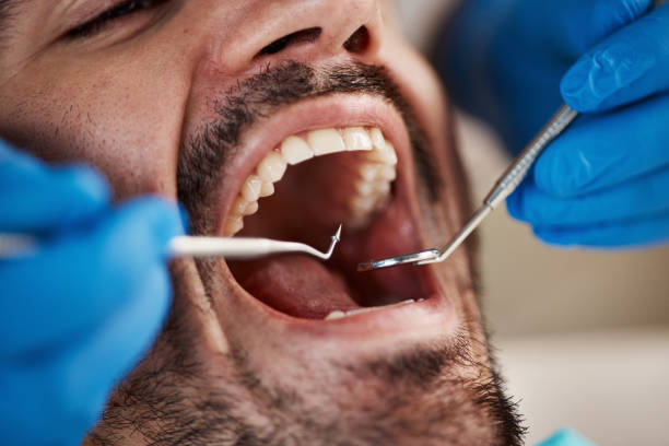Best Emergency Treatment for Oral Infections in Arcadia, SC